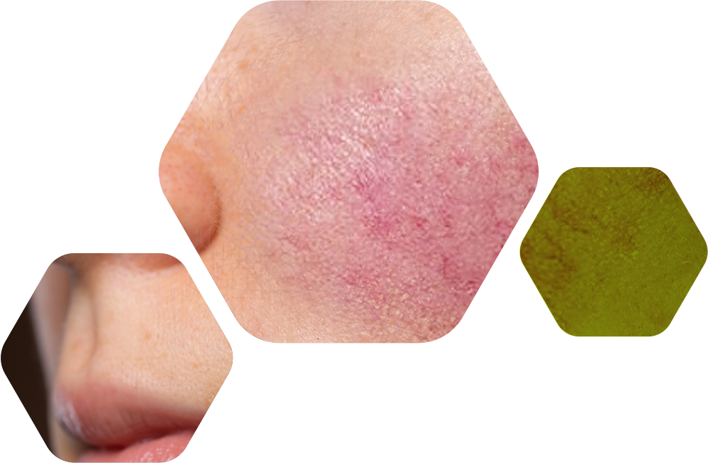 rosaceaHexagonos