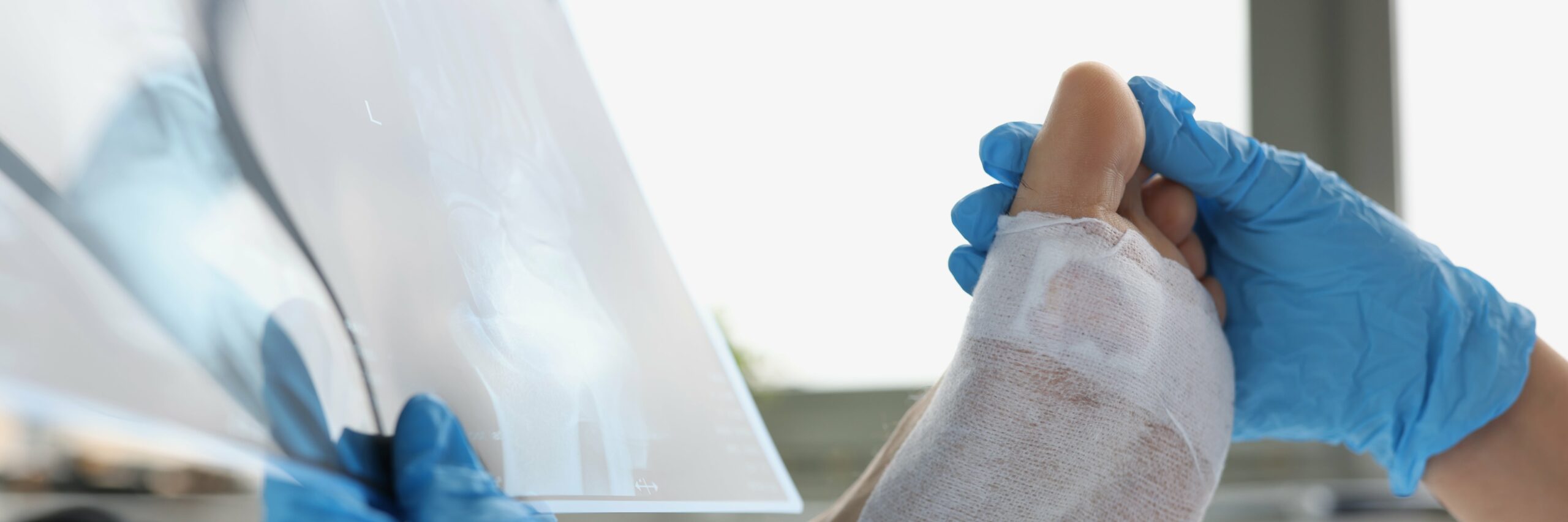 pie-diabetico-cuidados-de-enfermeria Son importantes los cuidados que debe tener un paciente de pie diabético, ya sea en casa o con un médico.