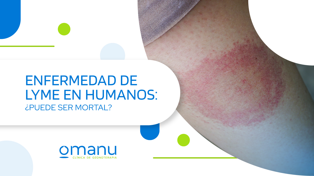 Imagen informativa sobre la enfermedad de Lyme en humanos, con el texto “¿Puede ser mortal?” y una fotografía de una erupción cutánea rojiza característica en la piel.