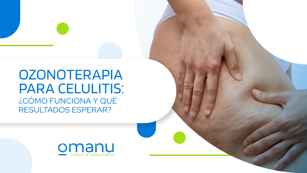 Ozonoterapia para celulitis, tratamiento estético para mejorar la piel de naranja
