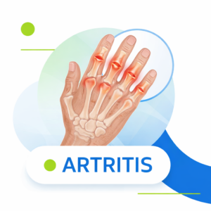 Ilustración médica de mano con articulaciones inflamadas por artritis destacadas en rojo.