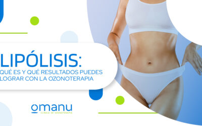 Lipólisis: qué es y qué resultados puedes lograr con la ozonoterapia