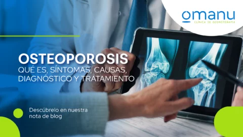 Osteoporosis: Qué es, síntomas, causas, diagnóstico y tratamiento