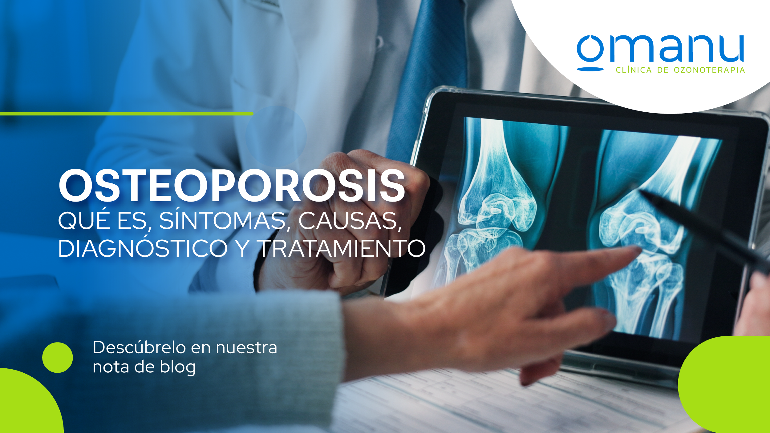 Médico revisando radiografías de rodillas para explicar la osteoporosis, sus síntomas, causas, diagnóstico y tratamiento.